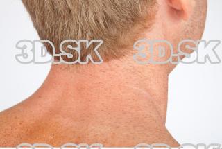 Neck texture of Alberto 0001